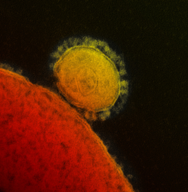 MERS-Coronavirus_NIAD